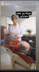 نمونه کار مزوتراپی دکتر فرانک تهرانی در مشهد