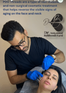 نمونه کار لیفت با نخ (دکتر محمد بهبودی فرد)