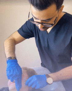 نمونه کار لیفت با نخ (دکتر محمد بهبودی فرد)