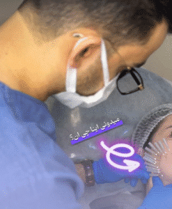 نمونه کار لیفت با نخ (دکتر محمد بهبودی فرد)