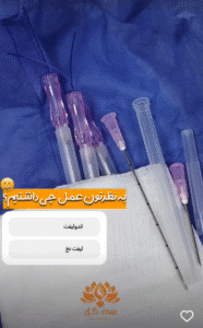 نمونه کار لیفت با نخ (کلینیک زیبایی سی گل)