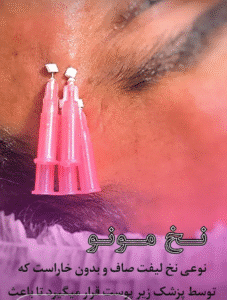 نمونه کار لیفت با نخ (دکتر شیما مطیعی فر)