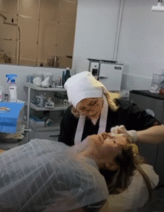 نمونه کار لیفت با نخ (دکتر شیما مطیعی فر)