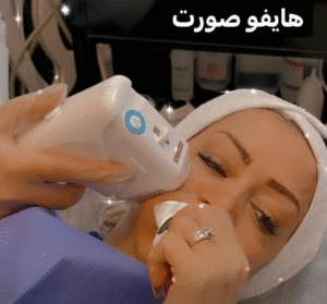 نمونه کار هایفوتراپی (کلینیک زیبایی دلوین)