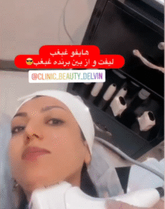 نمونه کار هایفوتراپی (کلینیک زیبایی دلوین)