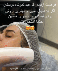 نمونه کار هایفوتراپی (کلینیک زیبایی دلوین)