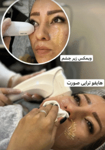 نمونه کار هایفوتراپی (کلینیک زیبایی دلوین)
