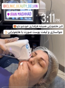 نمونه کار هایفوتراپی (کلینیک زیبایی دلوین)