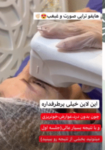 نمونه کار هایفوتراپی (کلینیک زیبایی دلوین)