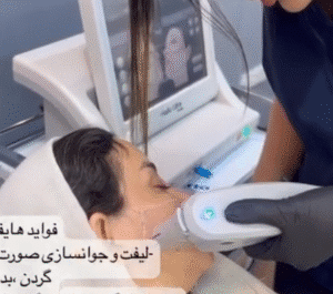 نمونه کار هایفوتراپی (دکتر صهبا صمدی)