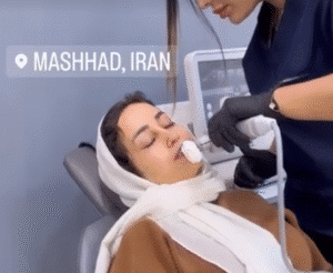 نمونه کار هایفوتراپی (دکتر صهبا صمدی)