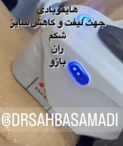 نمونه کار هایفوتراپی (دکتر صهبا صمدی)