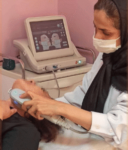 نمونه کار هایفوتراپی (کلینیک زیبایی سی گل)