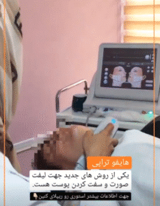 نمونه کار هایفوتراپی (کلینیک زیبایی سی گل)