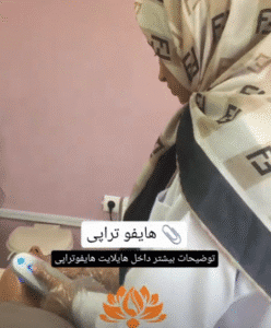 نمونه کار هایفوتراپی (کلینیک زیبایی سی گل)