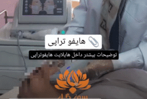 نمونه کار هایفوتراپی (کلینیک زیبایی سی گل)