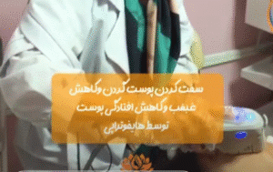 نمونه کار هایفوتراپی (کلینیک زیبایی سی گل)