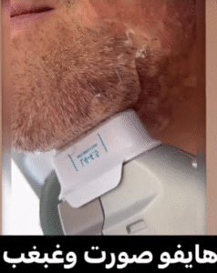نمونه کار هایفوتراپی (دکتر الهه مولوی)