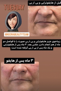 نمونه کار هایفوتراپی (دکتر الهه مولوی)