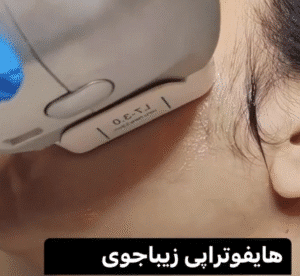 نمونه کار هایفوتراپی (دکتر الهه مولوی)