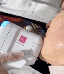 نمونه کار هایفوتراپی (کلینیک سلامت ایده آل)