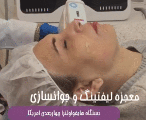 نمونه کار هایفوتراپی (کلینیک نوآوران زیبایی)