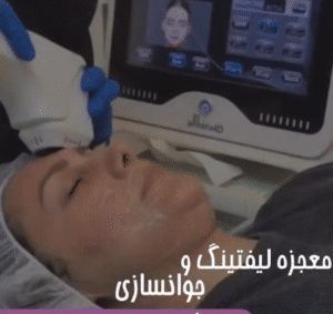 نمونه کار هایفوتراپی (کلینیک نوآوران زیبایی)