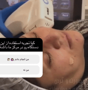 نمونه کار هایفوتراپی (کلینیک نوآوران زیبایی)