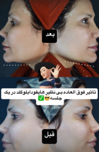 نمونه کار هایفوتراپی (دکتر سحر پارسایی)