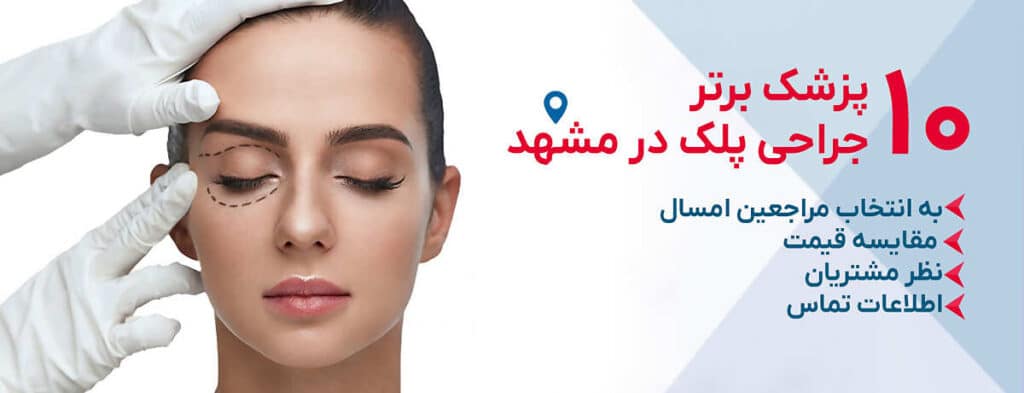 بهترین دکتر جراح پلک در مشهد