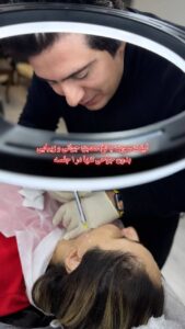 نمونه کار لیفت با نخ (دکتر سیاوش وکیلی)