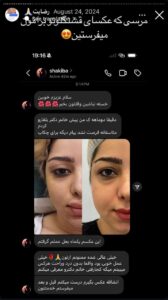 نظرات مراجعین بلفاروپلاستی دکتر مریم پادرایی