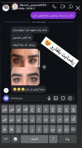 نظرات مراجعین بلفاروپلاستی دکتر مریم پادرایی
