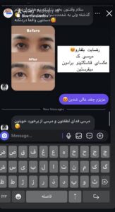 نظرات مراجعین بلفاروپلاستی دکتر مریم پادرایی