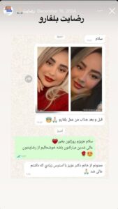 نظرات مراجعین بلفاروپلاستی دکتر مریم پادرایی
