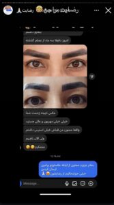 نظرات مراجعین بلفاروپلاستی دکتر مریم پادرایی