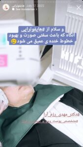نمونه کار پوست دکتر مهدی رزم آرا در مشهد