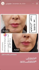 نمونه کار پوست دکتر مهدی رزم آرا در مشهد