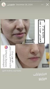 نمونه کار پوست دکتر مهدی رزم آرا در مشهد