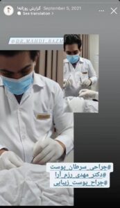 نمونه کار پوست دکتر مهدی رزم آرا در مشهد