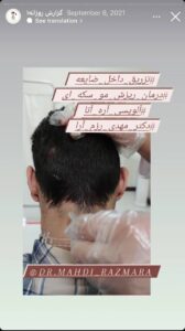 نمونه کار پوست دکتر مهدی رزم آرا در مشهد