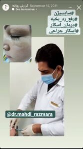 نمونه کار پوست دکتر مهدی رزم آرا در مشهد