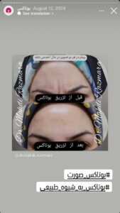 نمونه کار پوست دکتر مهدی رزم آرا در مشهد