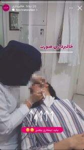 نمونه کار پوست دکتر الهه اندخشیده در مشهد