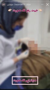 نمونه کار پوست دکتر الهه اندخشیده در مشهد