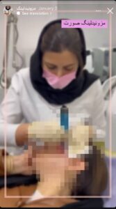 نمونه کار پوست دکتر الهه اندخشیده در مشهد