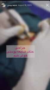 نمونه کار پوست دکتر الهه اندخشیده در مشهد
