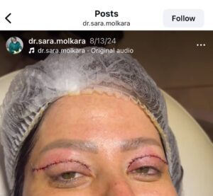 نمونه کار دکتر سارا ملک آرا در مشهد