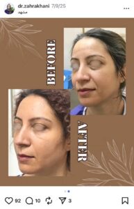 نمونه کار دکتر زهرا خانی در مشهد