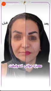 نمونه کار دکتر رزیتا دلقندی در مشهد